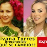 Silvana Torres Veneno Torres antes después